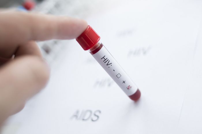Минздрав РФ разработал новый порядок оказания помощи ВИЧ-инфицированным