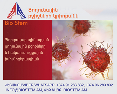 Պորտալարային արյան ցողունային բջիջներն ընդգրկվել են հակաուռուցքային իմունոթերապիայի մեջ. biostem.am