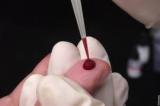 Исследования: лабораторная - иммунологическое исследование крови