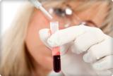 Диагностика: лабораторная - иммуноферментное исследование крови