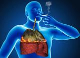 Ծխողի թոքերը ծխելը թողնելուց հետո կախարդական կերպով վերականգնվում են․ հետազոտություն. oncology.am