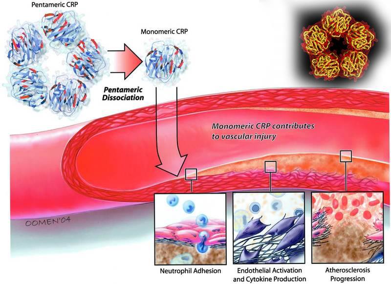 С-ռեակտիվ սպիտակուց (CRP, ՑՌՍ) 